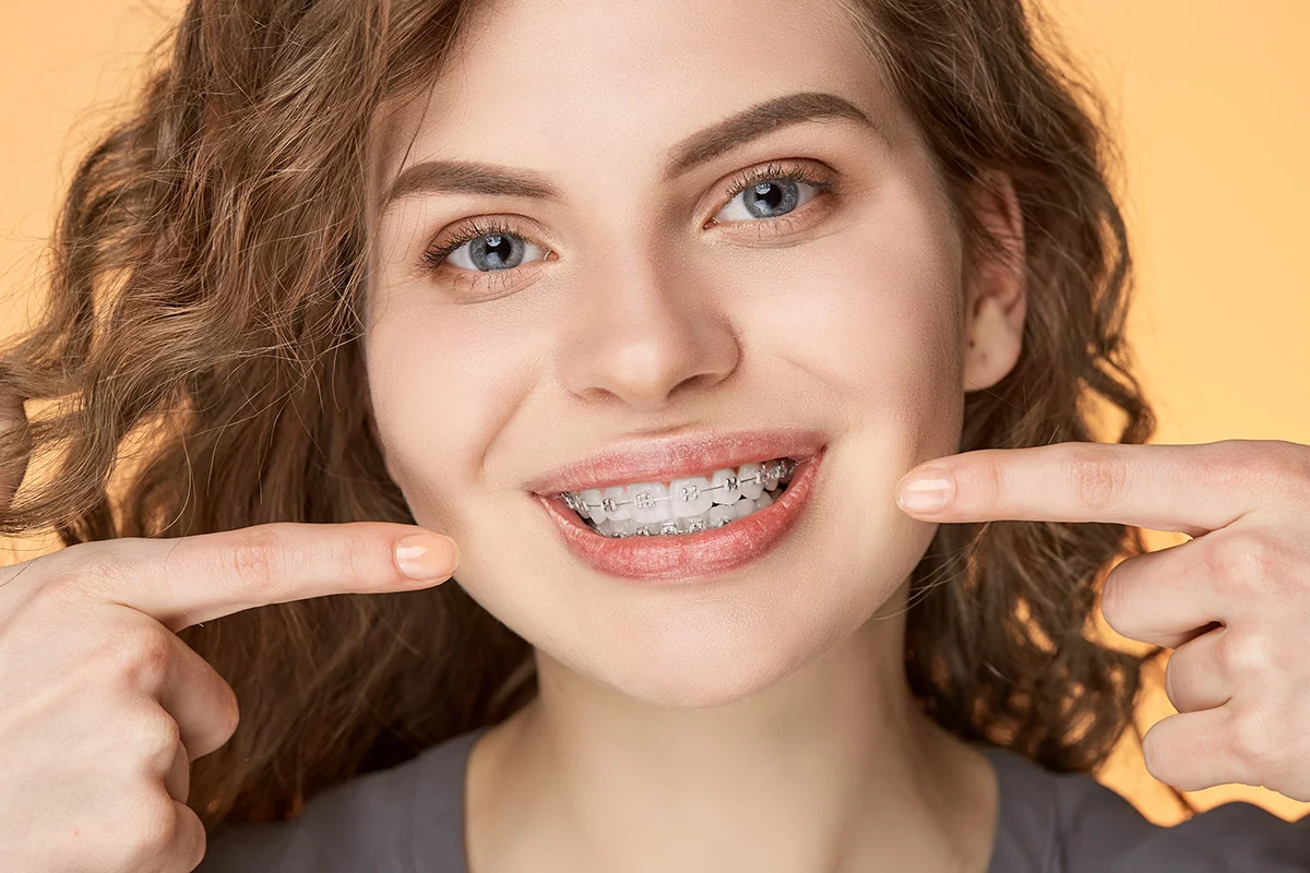 aparat dental ceramic
